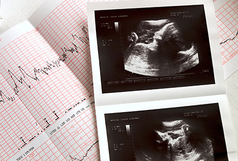 imagem ilustrativa mostra exames de ultrassom