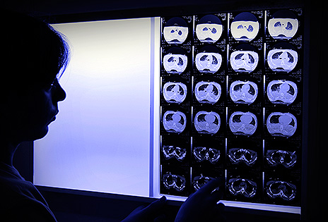 Imagem em plano fechado mostra médica observando radiografia colocada sobre quadro de luz pendurado em parede